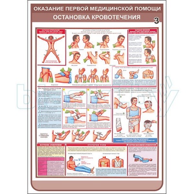 Плакат Оказание первой медицинской помощи при остановке кровотечения